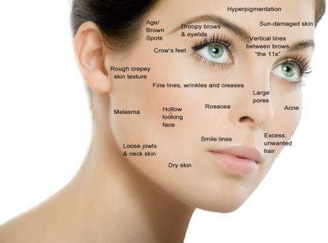Skin Specialists Cure Your Acne Problems